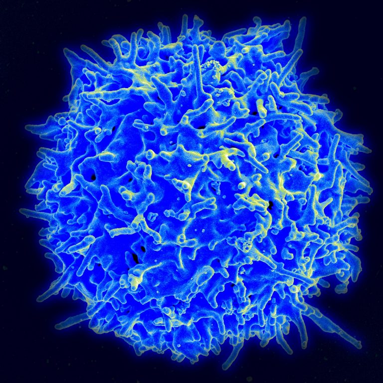 Anaphylaxis Traced to Unlucky Tfh13, a Rare Immune Cell Subtype