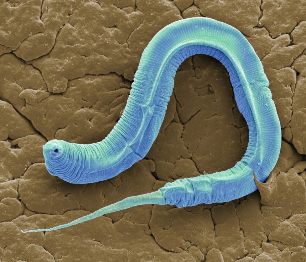 C elegans, SEM