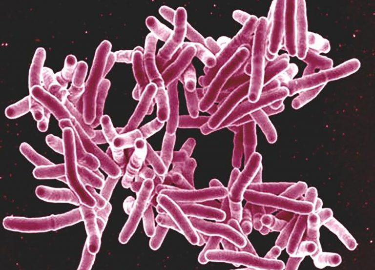 How One Immune Cell Directs Another To Aid Tuberculosis Control