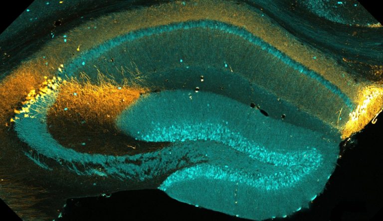 Mitochondria Shown to Regulate Brain’s CA2 Subregion, Highlighting a Potential Target for Neuro Disorders
