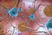 Targeting Cholesterol May Help Treat Alzheimer’s and Related Dementias