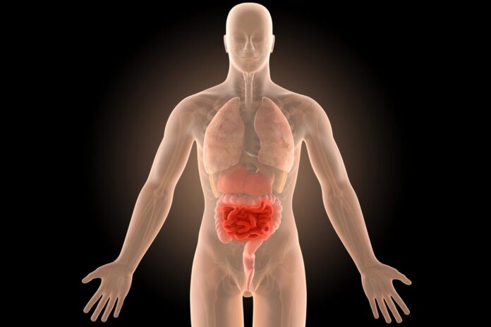3d illustration human body crohn's intestines infection with clipping path.