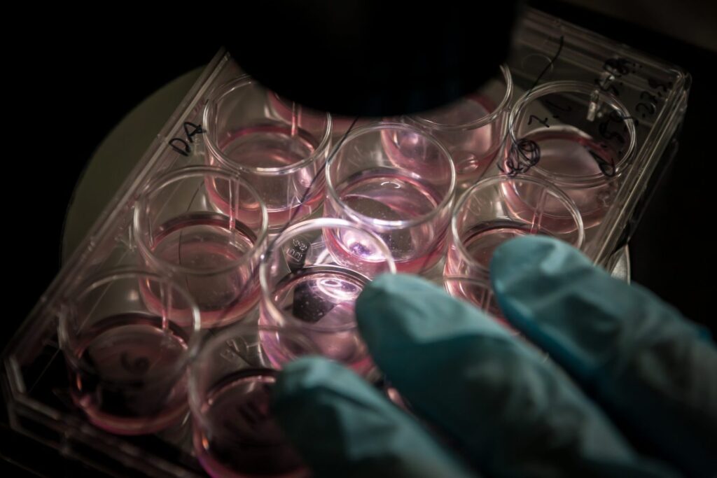 A gloved hand holding a stem cell culture
