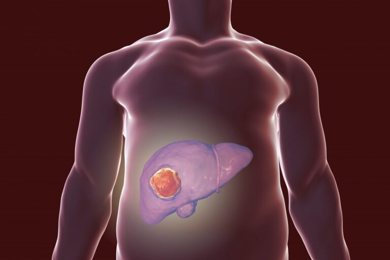 Researchers Uncover New Driver of Carcinogenesis in Liver Cancer