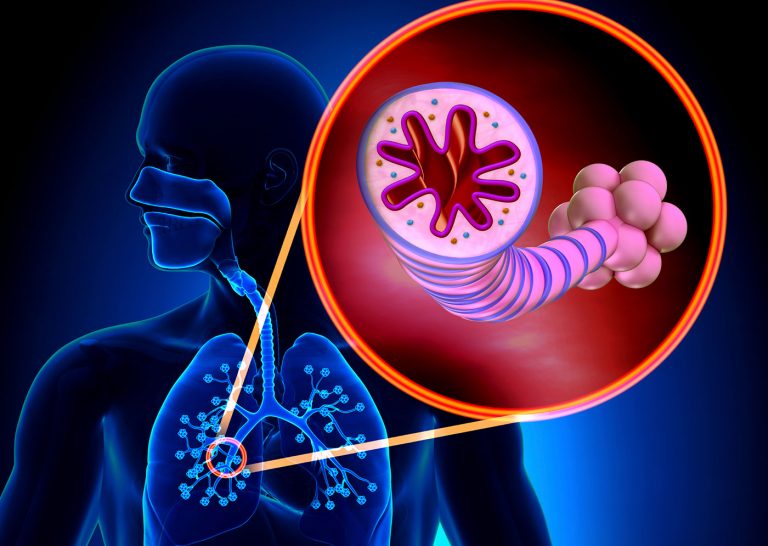 Asthma Therapy May Receive a Boost from New Caspase-11 Finding