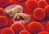 Repeated Malaria Expands Innate Immune Cell-Type in Ugandan Children