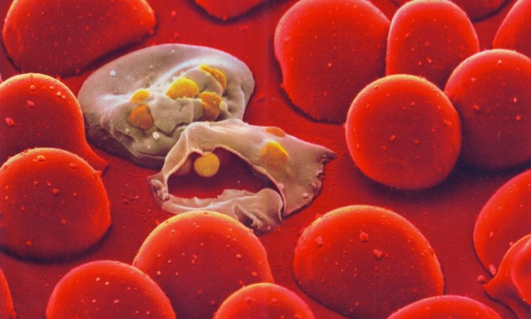 Malaria Transport Channel Identified Connecting Parasite to Red Blood Cell