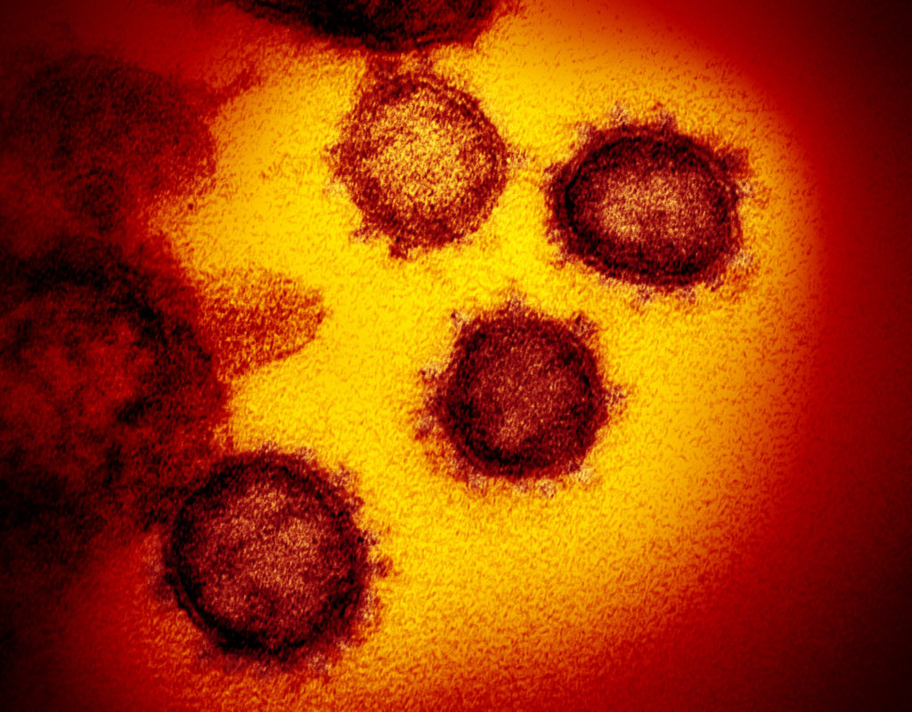 exemple de vindecare de la varicoză semar varicoză