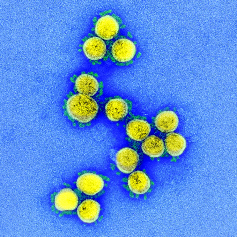 Regeneron, Sanofi Launch Clinical Trial of Kevzara as Coronavirus Treatment