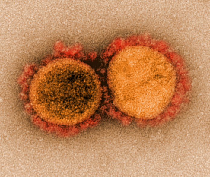 Coronavirus COV-19