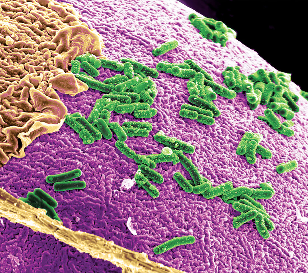 Model of gut microbiome