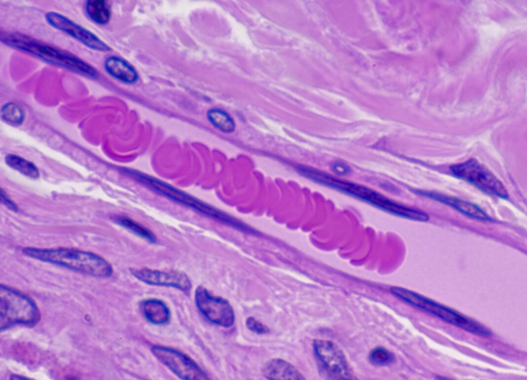 CAPILLARY ANATOMY--ENDOTHELIUM, LUMEN AND RED BLOOD CELLS 400X