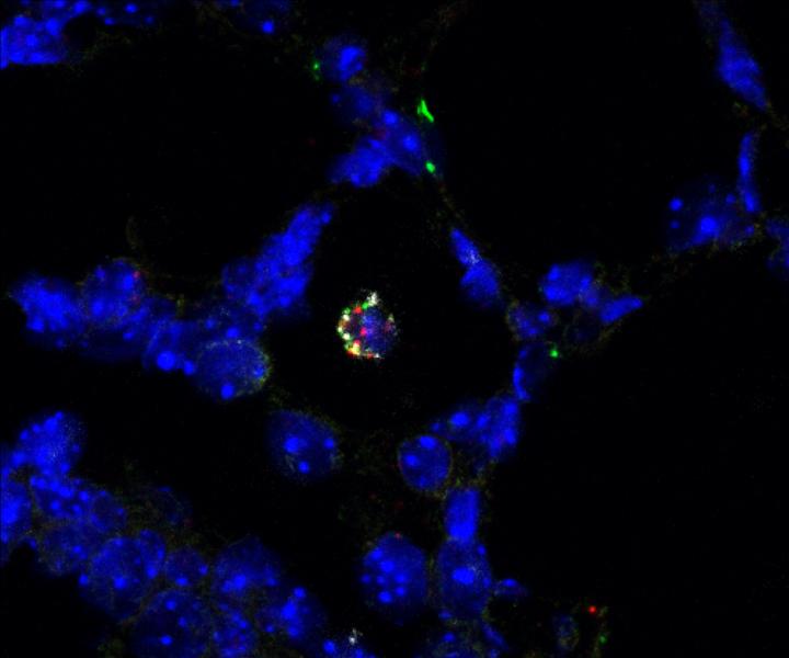 Increase of Immune Cells Found in Mouse Lungs at Birth
