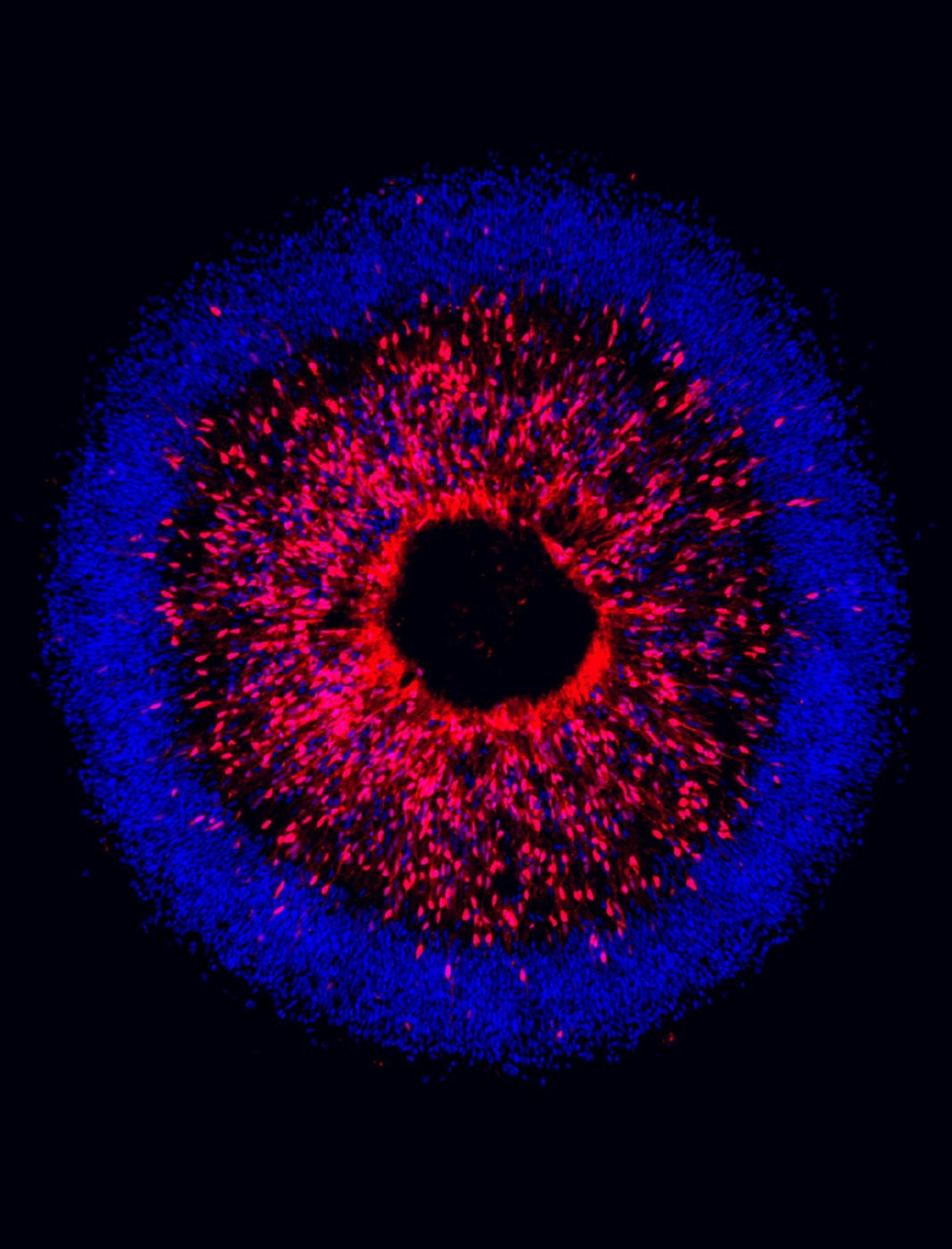 Stem cell model used to study degeneration in glaucoma