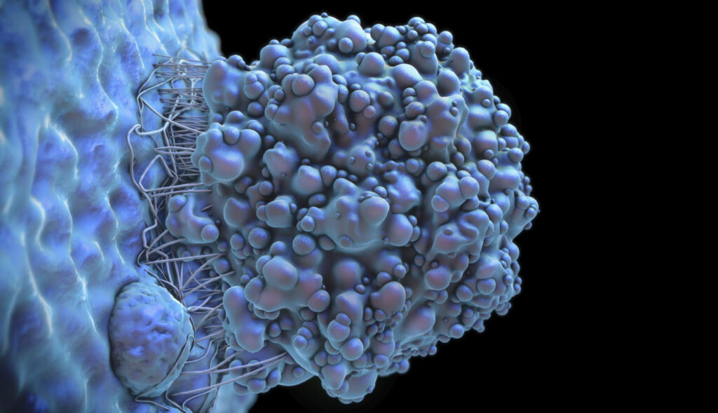 Cancer cell, illustration