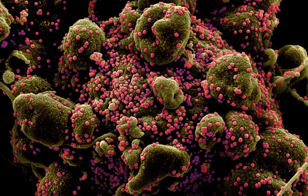 coronavirus
