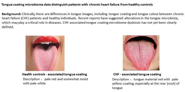 CHF tongue