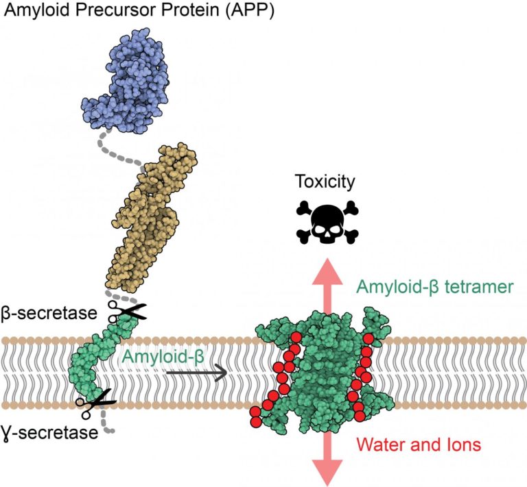Atomic Structure of Alzheimer’s Amyloid Protein Reveals New Toxicity ...