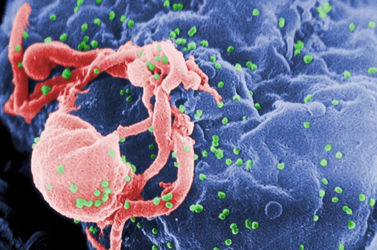 Cryo-EM Research May Help Develop Antiviral Therapy against HIV