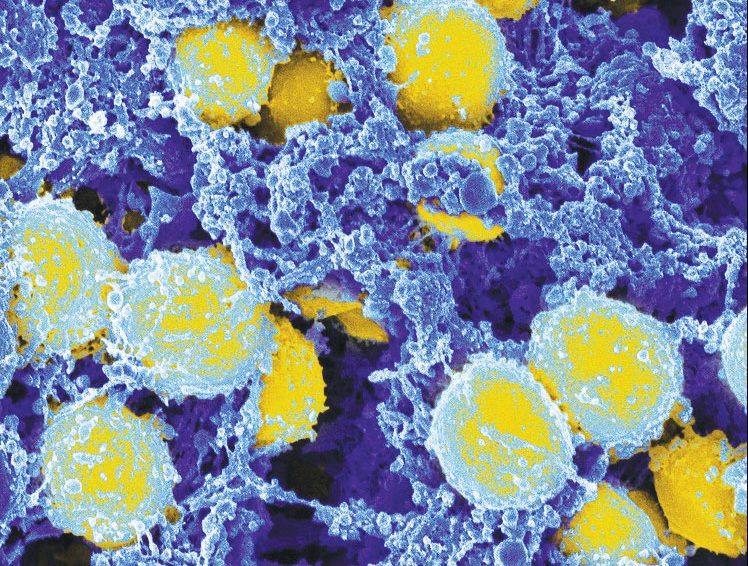 Novel Genetic Insights into <i>Staphylococcus aureus</i> Uncovered
