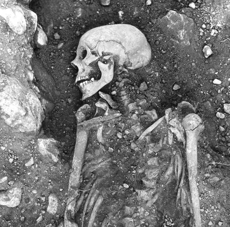 Smallpox Found in Viking Teeth Proves Disease Plagued Humans for 1400 Years