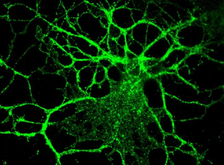 Myelin-producing brain cell