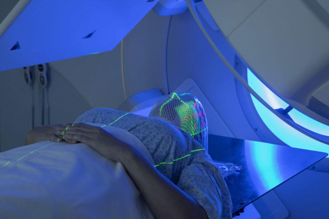 Woman Receiving Radiation Therapy Treatments for Head & NeckCancer