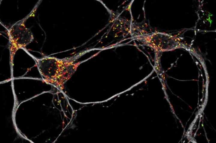 Nerve Cells Can Circumvent Mitochondrial Damage with Metabolic Rewiring