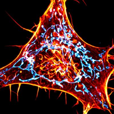 Cytoskeleton Protein’s New Role Magnified by Novel Imaging Method