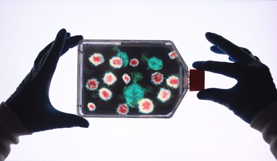 Pharmaceutical research into diseases and pandemics. Scientist holding a cell jar with a electron microscope image of a virus inside.