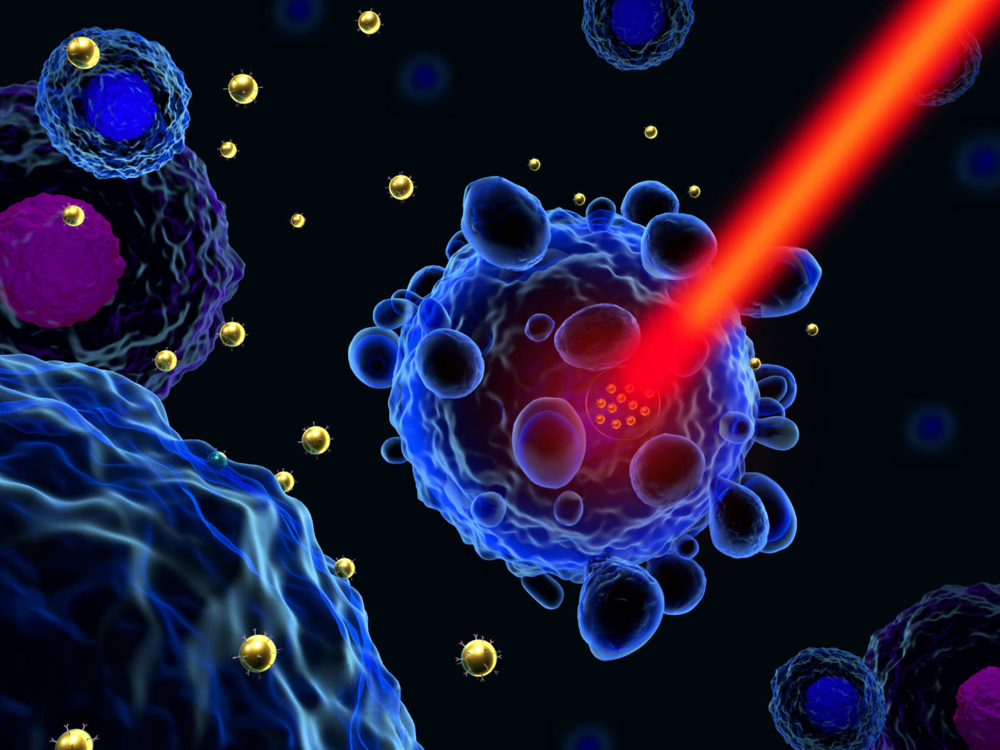 Gold Nanoparticles Produced in Cancer Cells with Novel Technique