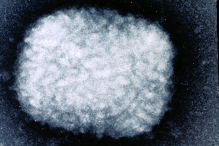 Poxviruses Have Gene to “Blind” Host Cells’ DNA Sensors