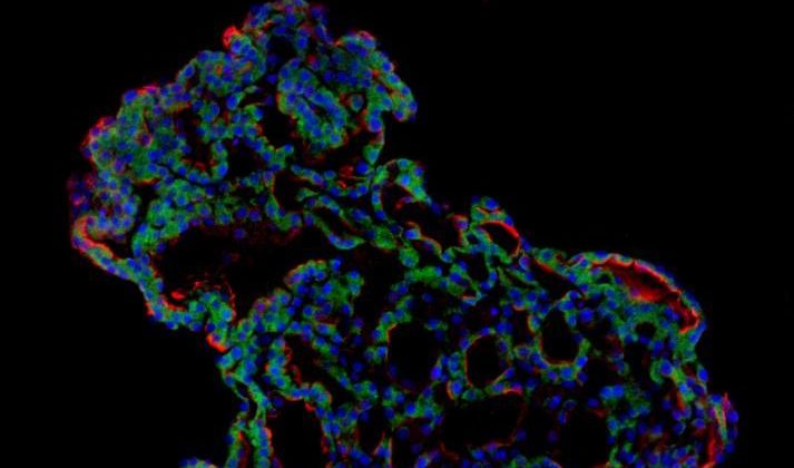 SARS-CoV-2 Infection Modeled in 3-D Stem Cell Culture Model