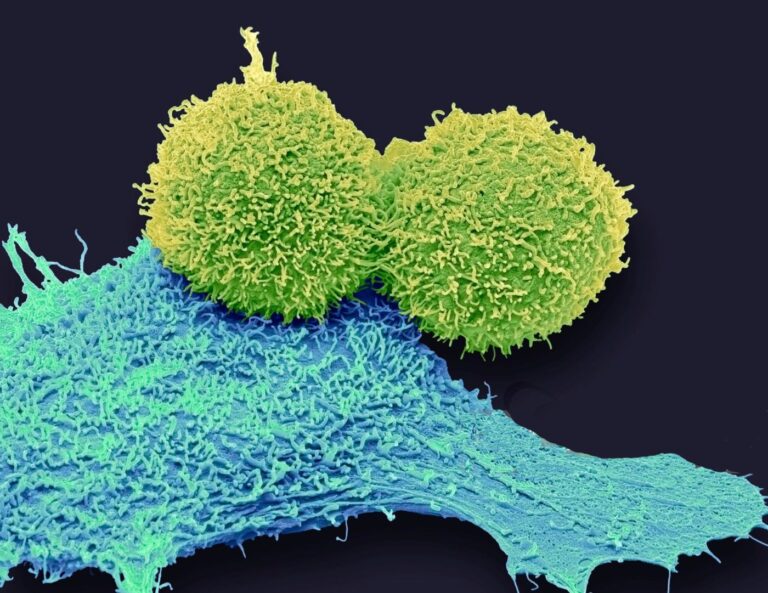 Immune Training Teaches Certain Cells to Target Cancer