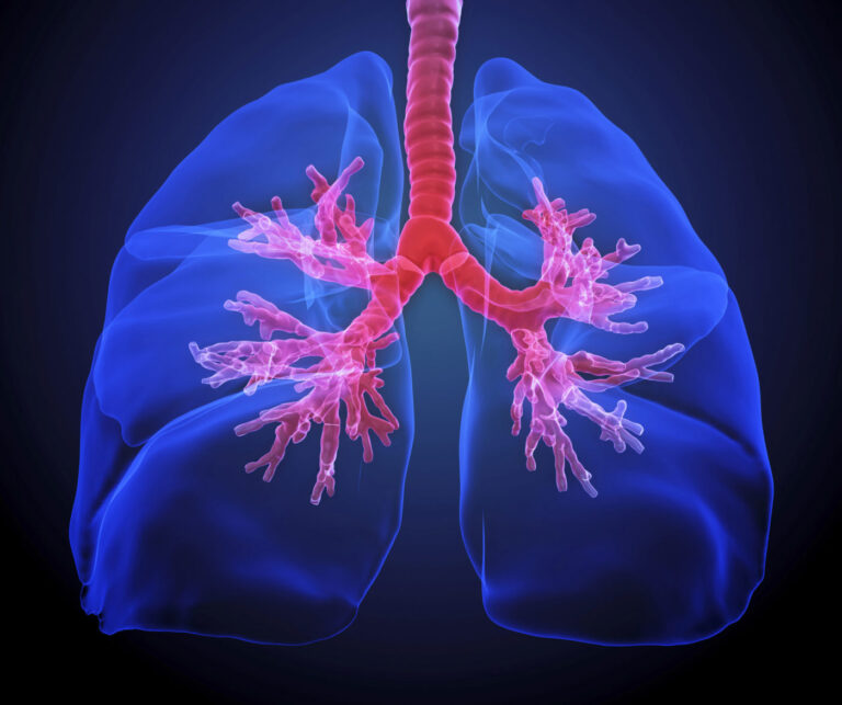 Combination Therapy against Resistant Lung Tumors Shows Promise in Mice
