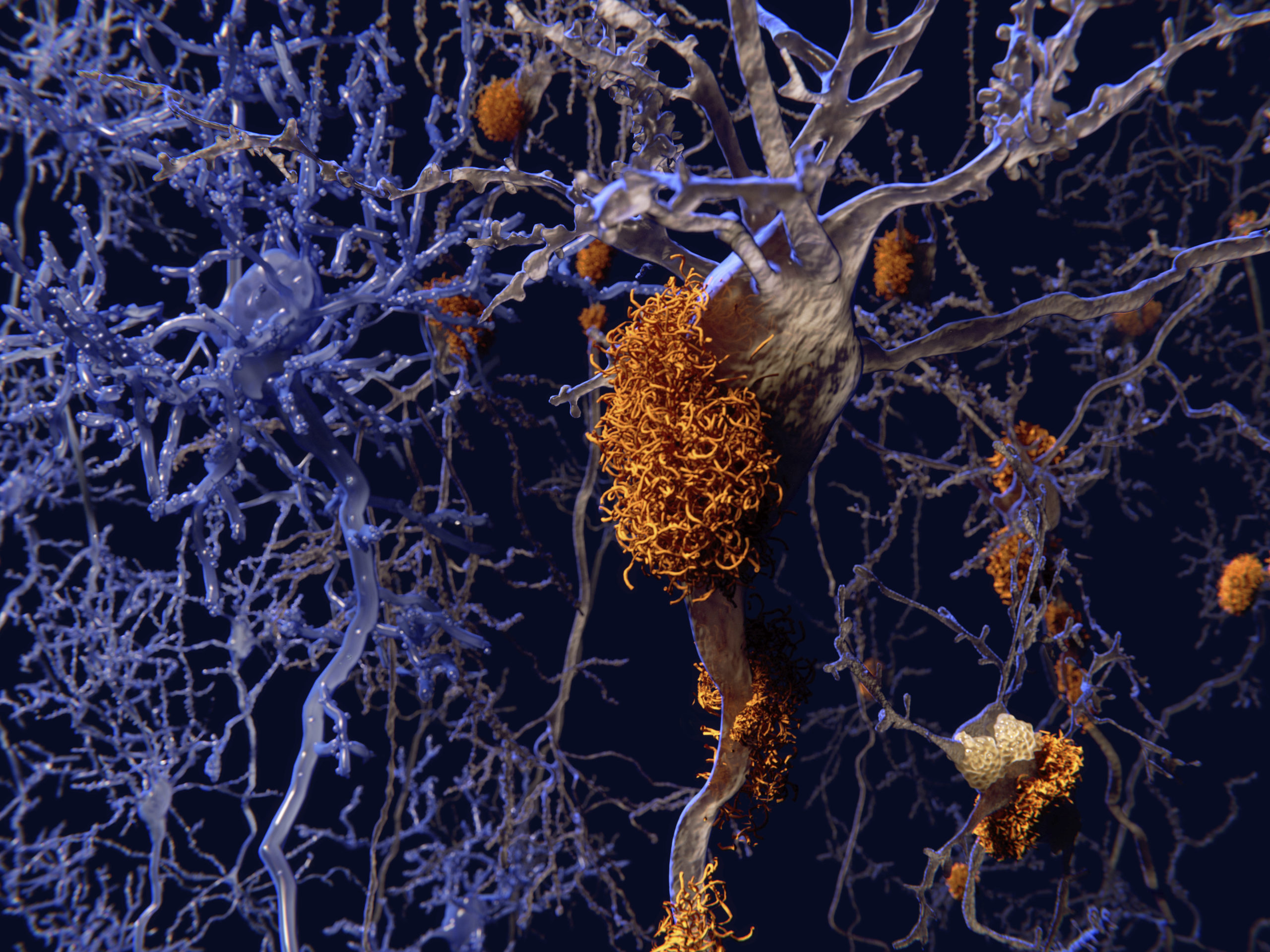 FDA Panel Recommends against Alzheimer's Candidate Aducanumab