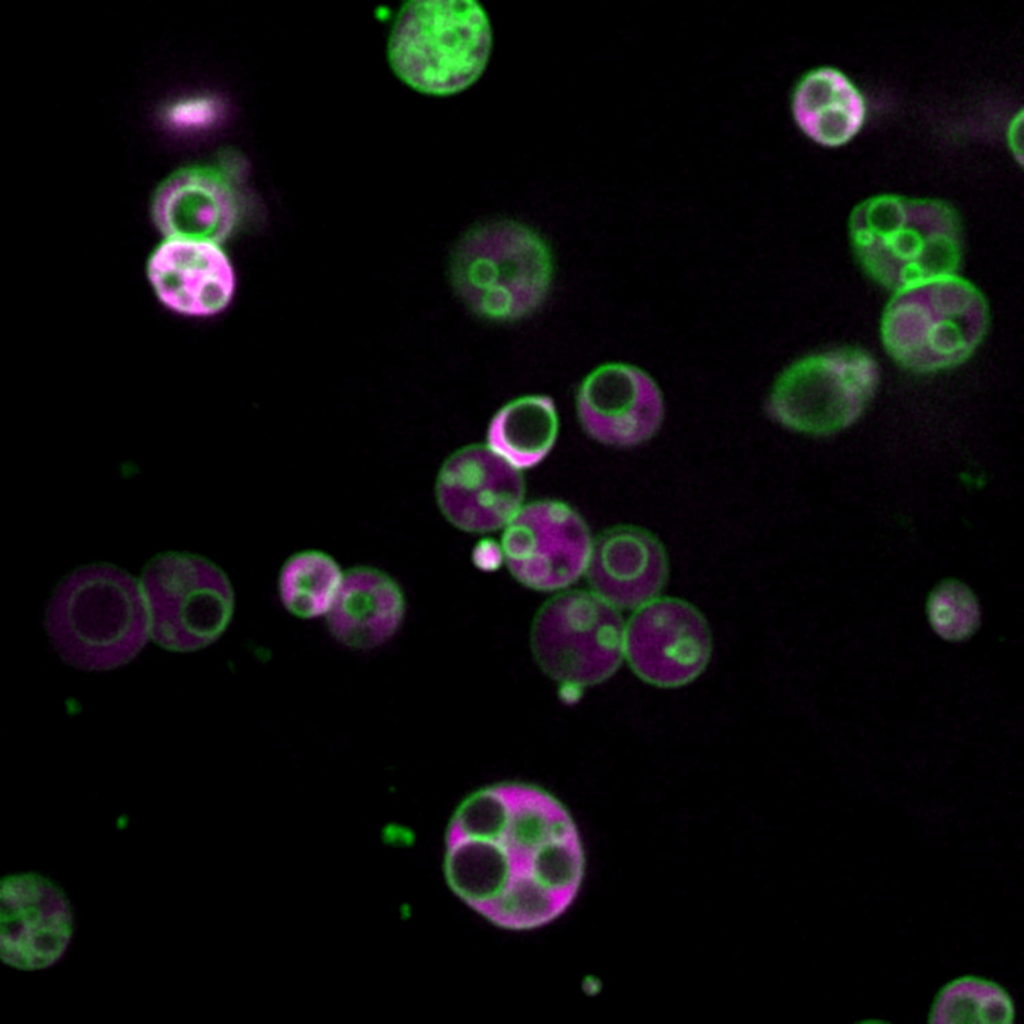 Image shows internal compartments in peroxisomes.