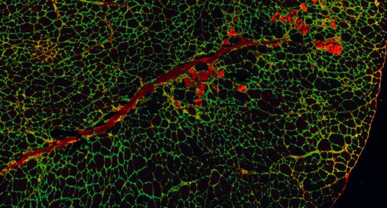 Inhibition of Ion Channel May Prolong Survival of Duchenne Muscular Dystrophy in Mice