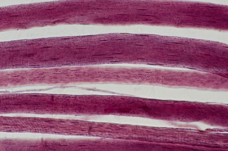 Researchers Uncover How a Protein Regulates Skeletal Muscle Growth