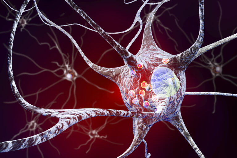 Novel Insights into Protein Aggregation in Parkinson’s Disease Revealed