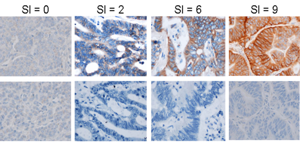 Immunohistochemistry (IHC)