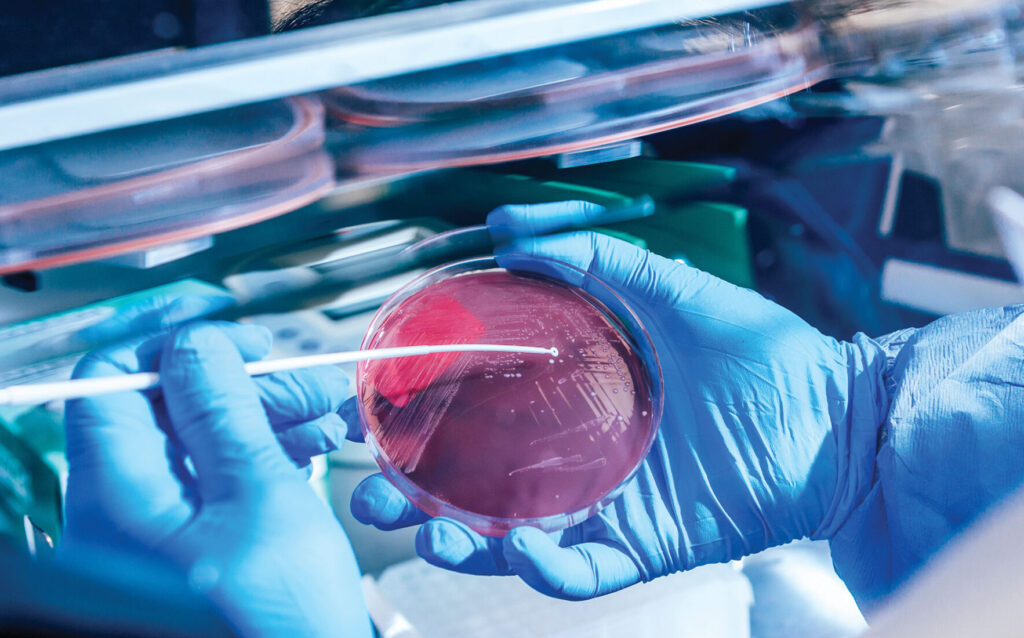 bacteria in a petri dish