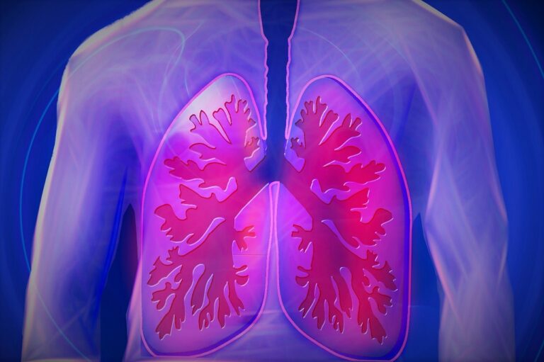 Allergy Drug Added to Immunotherapy Benefits Lung Cancer Therapy in Small Trial