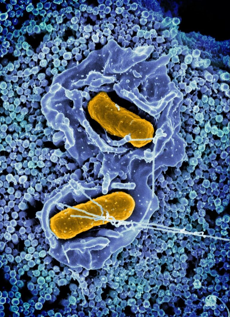 Researchers Uncover How Salmonella Bacteria Colonize the Gut