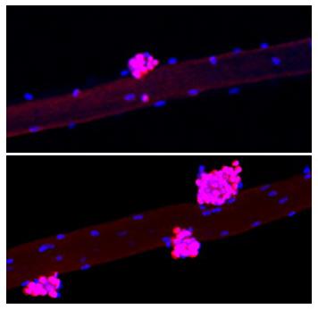 Molecular Compounds Accelerate Muscle Regeneration in Mice