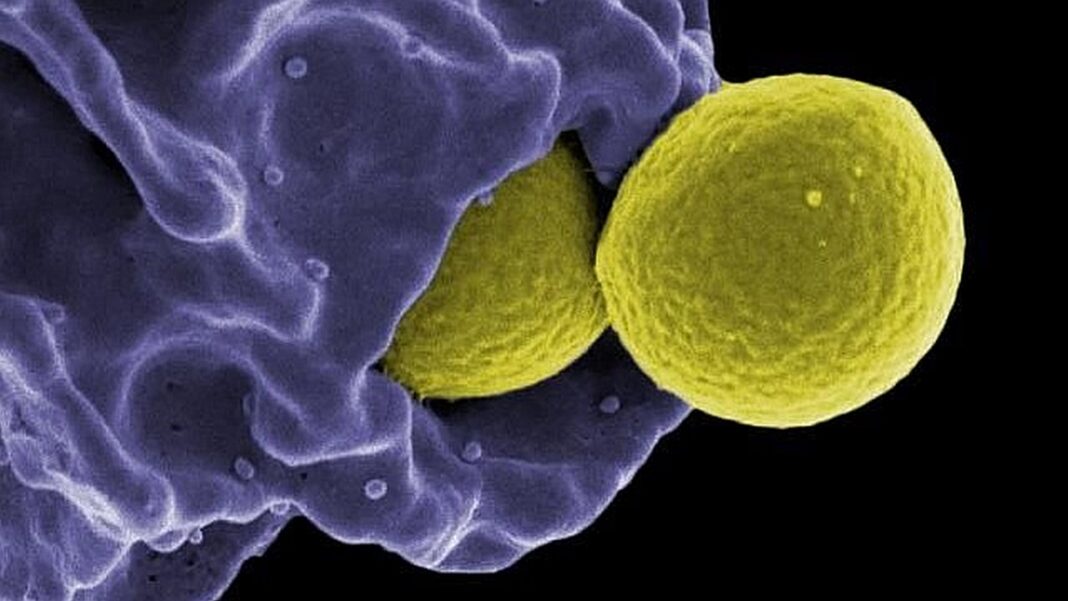 Scanning electron micrograph of methicillin-resistant Staphylococcus aureus (MRSA) bacteria being engulfed by a neutrophil [National Institute of Allergy and Infectious Diseases, National Institutes of Health]