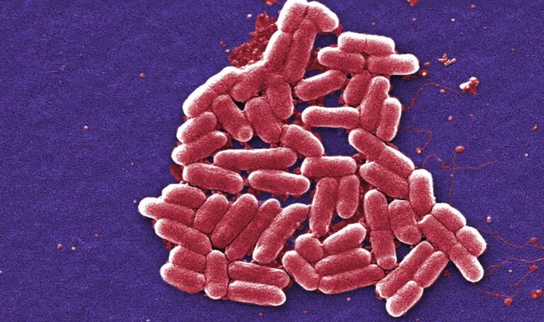 Shigella Enzyme Blocks Human Cell Death to Establish Infection