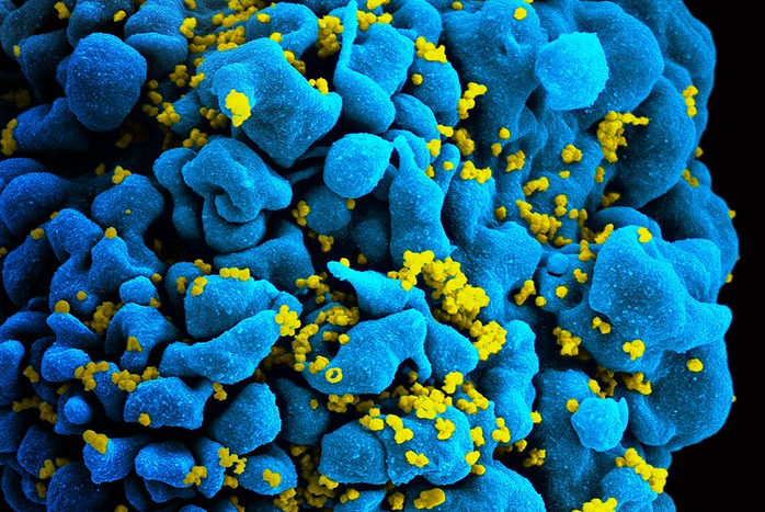 HIV Vaccine Disappointment: Trial Data Show Lack of Sufficient Protection