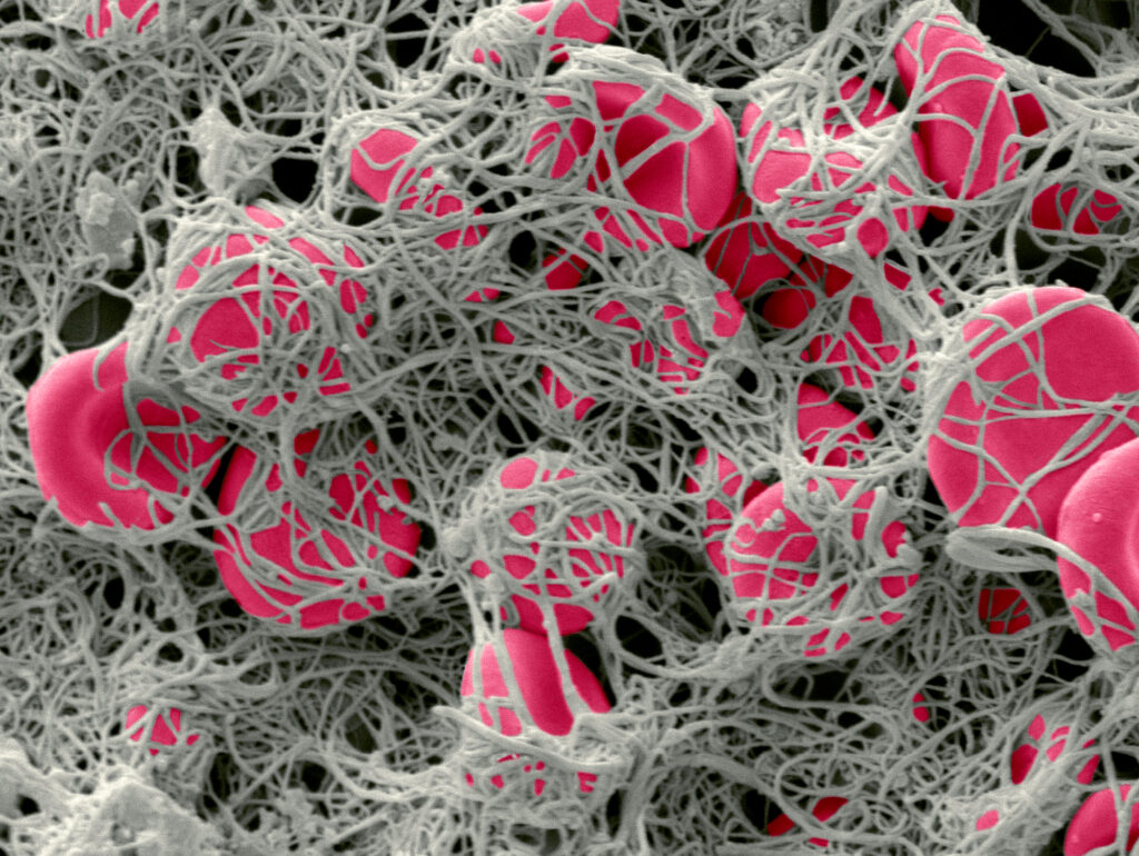 “Click Clotting” Technique Rapidly Creates Stronger Blood Clots