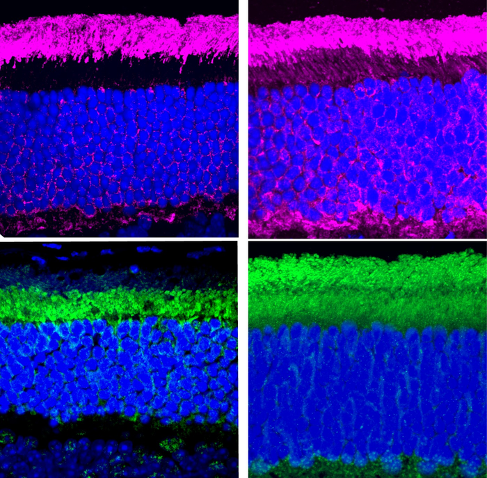 Retinoid Therapy Improves Vision in Mice with Usher Syndrome